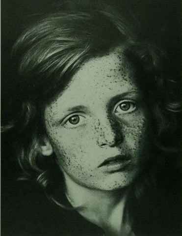 Young girl with freckles